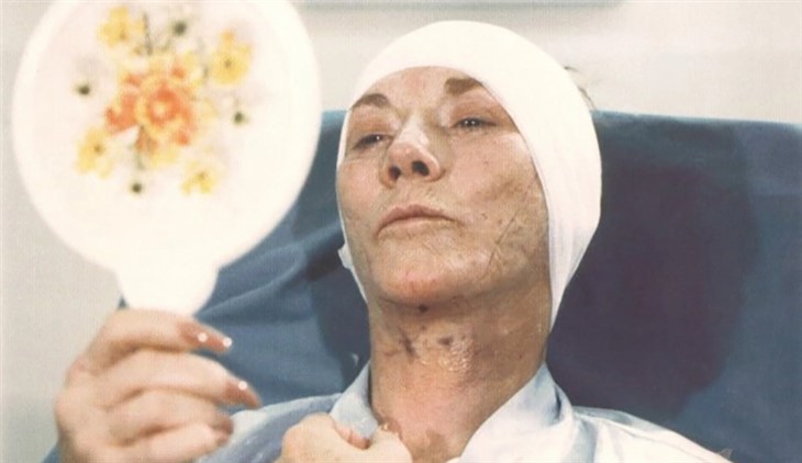 jeanne cooper with bandages on head looking at a hand mirror