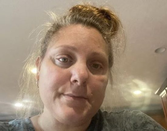Was 90 Day Fiance Star Anna Campisi Ill From Surgery Complications