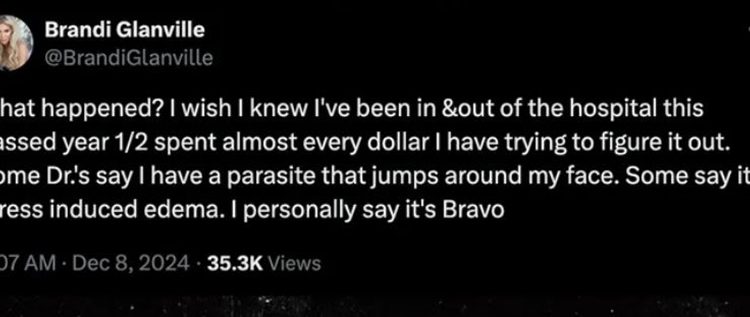 Brandi Glanville Has Seen Doctors