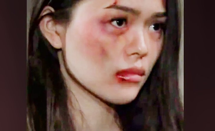 The Bold And The Beautiful Spoilers: Luna Nozawa Beat HERSELF?!