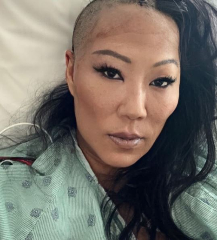 Bling Empire New York Star Lynn Ban Had Brain Surgery - Instagram