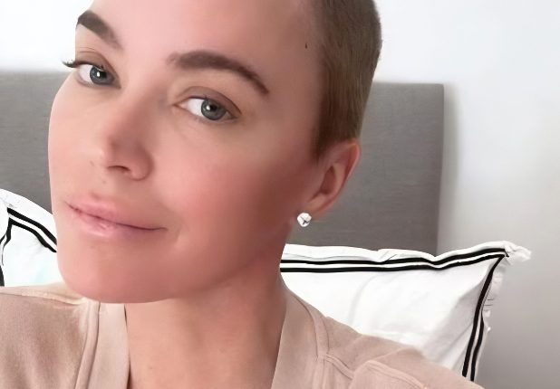 One side of Teddi’s head is bald – @teddimellencamp – Instagram