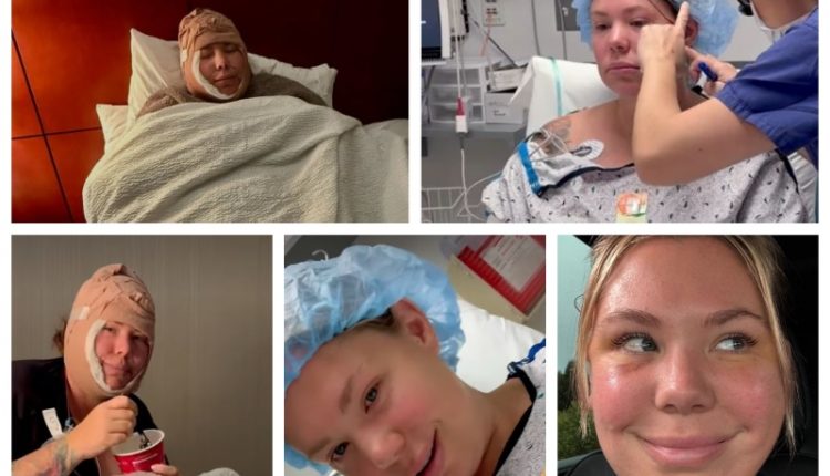 Kailyn shares double chin removal – Instagram