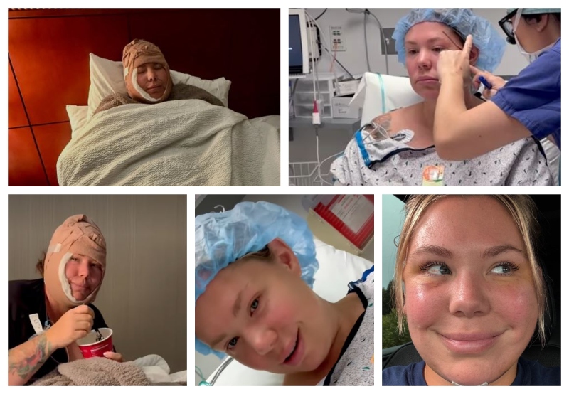 Kailyn shares double chin removal - Instagram