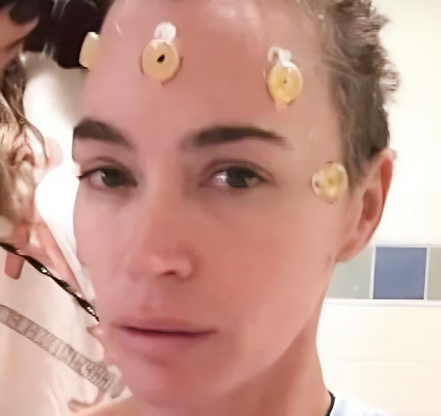 Teddi when she prepped for brain cancer surgery - via ET - YouTube