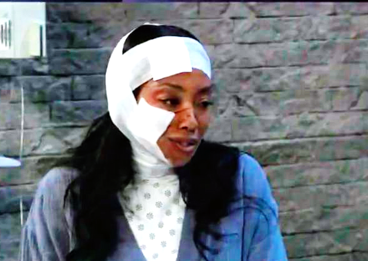 General Hospital Spoilers: Jordan’s Odd Behavior – PTSD or Brain Injury?