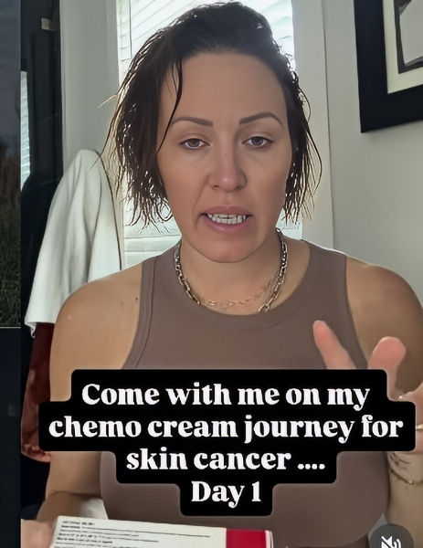 Braunwyn on day one of chemo cream - Instagram